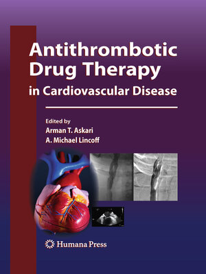 cover image of Antithrombotic Drug Therapy in Cardiovascular Disease